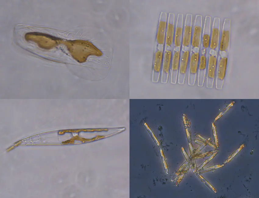 Microscopic plants found in sea ice Examples of the microscopic plants found within sea ice. Photos: © Vanessa Pitusi.